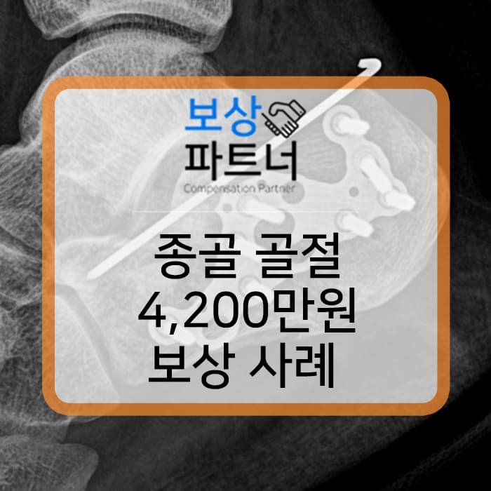 종골골절, 일하다 떨어짐(추락사고) 산재 장해등급표와 실제 보상 사례