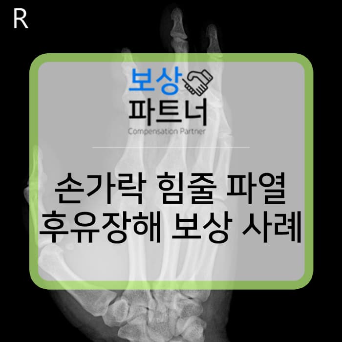 손가락 개방성 골절 및 굴곡건 파열 수술 후유증. 내 보험에서 후유장해 보상 받자!
