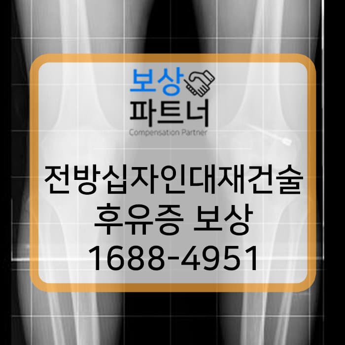 전방십자인대재건술 했다면? 슬관절의 후유장해 (후유증) 보상 확인해보세요!