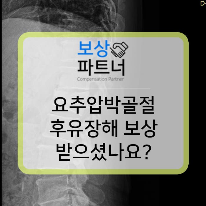 요추압박골절 1번척추 후유장해 보상 어떻게?