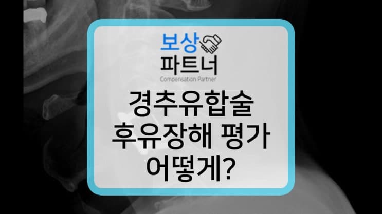 경추7번 압박골절 경추 유합술 후유장해 보상 성공 사례