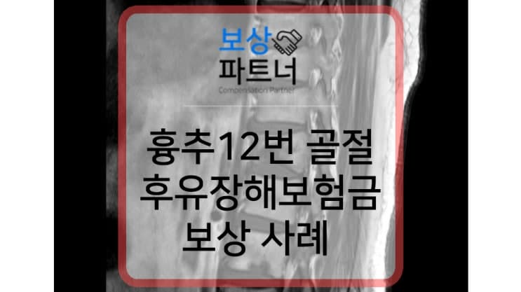 흉추12번 골절 아프지 않아도 후유장해보험금 보상 가능한 이유