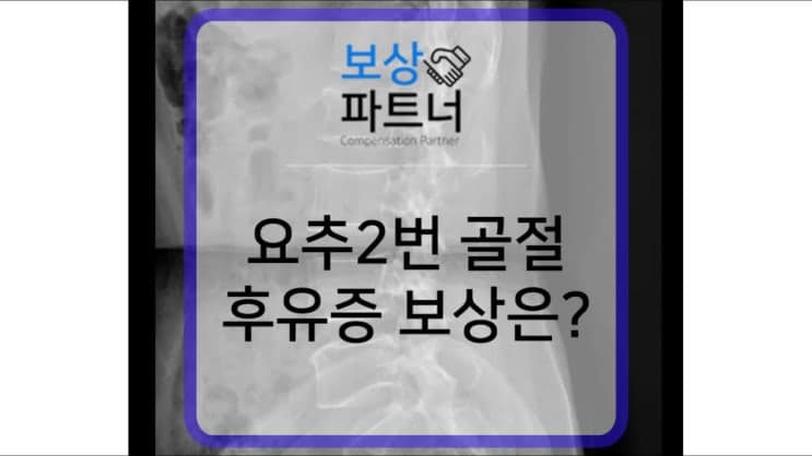 요추2번 척추압박골절 비수술, 보험사에서 후유증 장해 보상 받은 사례 _ 강원 태백
