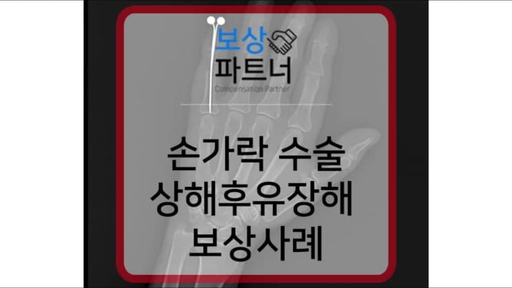 손가락 골절 핀 수술한 의뢰인, 상해후유장해 보상 성공 사례