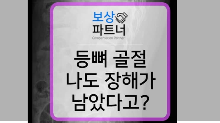 등뼈 골절, 후유장애보험금 알아보아야 하는 이유