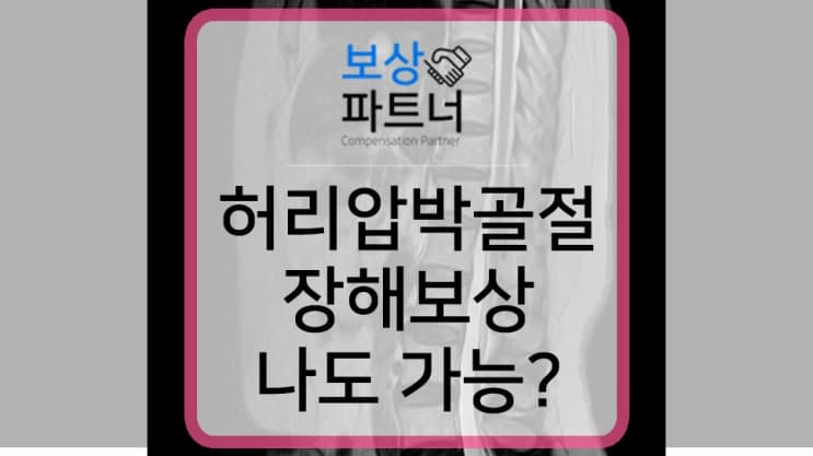 허리압박골절, 척추12번 허리보조기 착용 후유장해 보상사례