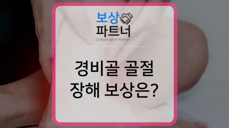 tibia fibula 골절 후유장해 보험금 알아봐야 하는 이유
