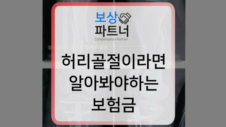 lumbar spine 허리골절 이라면 알아봐야 하는 후유장해보험금 실제 사례