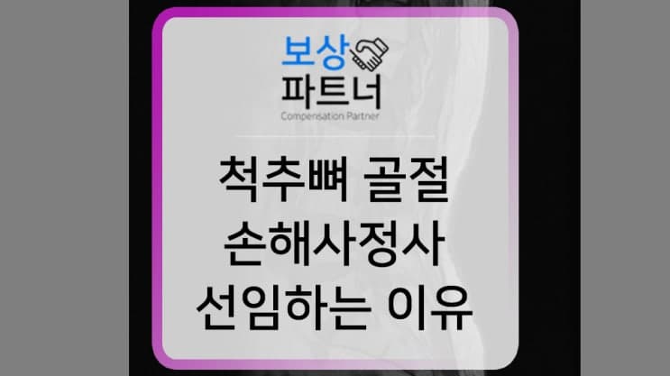 척추뼈골절, 손해사정사선임을 알아보고 계시다면? 실제사례 비교해보세요.