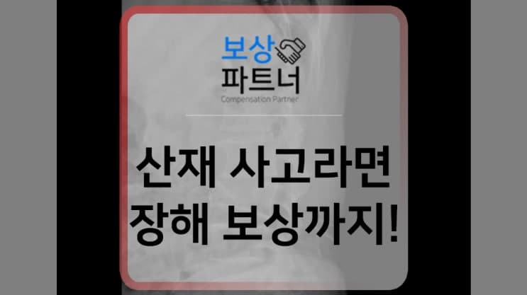 허리뼈 골절 추락사고를 당했다면? 산재 장해등급 보상 사례