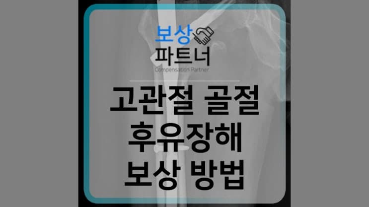 대퇴골전자간골절 고액 추가 보상 확인했나요?