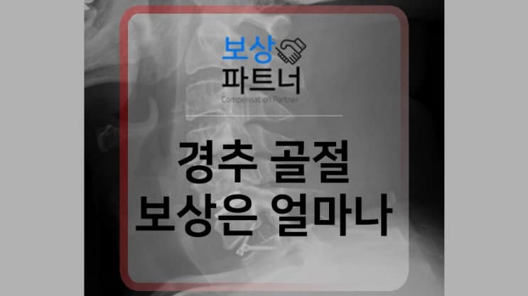 CERVICALSPINE INJURIES, 경추골절이라면 알아봐야 할 추가보상 소개