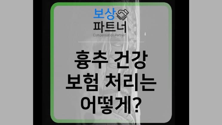 THETHORACICSPINE 흉추 압박골절 진단받아 보상받았어요.