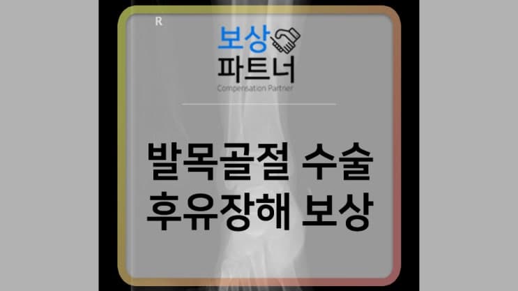 경비골 골절, 후유장해 보험금 이만큼 받았어요.