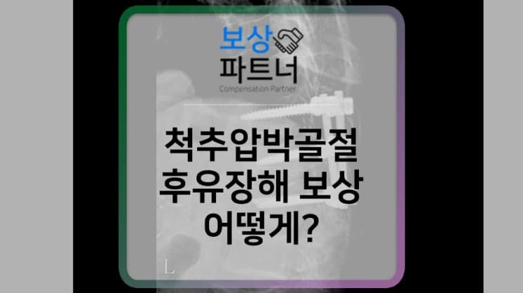compression fx 척추 압박 골절 후유장해 보험 청구