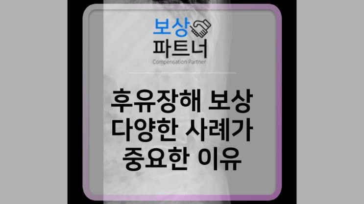 방출성 골절 분쇄골절 고정나사 허리수술 보험 처리는?