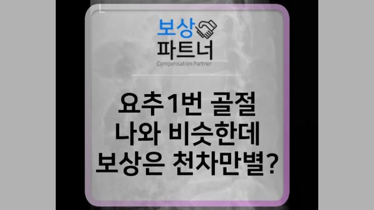 S32090, 요추 1번 골절, compression fractures of vertebrae, 후유장해 손해사정사 보상 선임