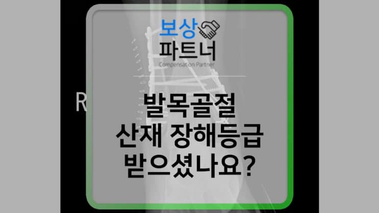 8주 진단, 발목 골절 수술 ♦ 산재보험 장해급여 등급 도움받고 싶다면