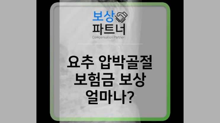 진단코드 s32 요추 압박골절 후유장해 보험금 보상 상담원한다면?