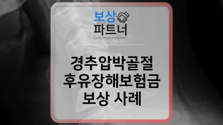 경추압박골절 경추뼈 후유장해 보험금 손해사정 상담을 원한다면?