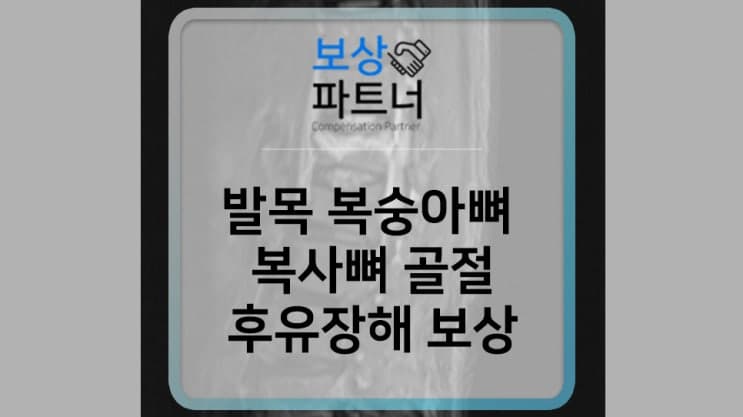 발목 복숭아뼈 골절 상해후유장해 보상 사례