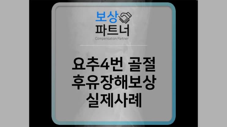 요추 골절 후유장해 보상사례