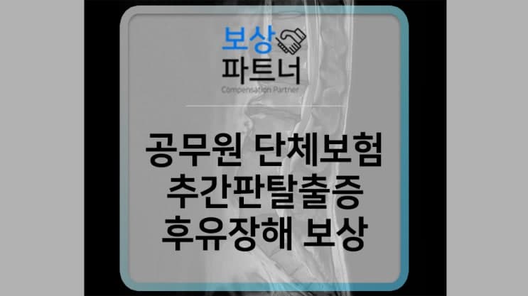 공무원 단체보험 후유장해 보험금 청구 사례 (신경뿌리병증을 동반한 추간판탈출증)