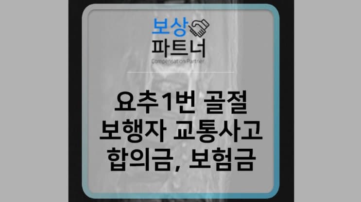요추 1번 압박골절- 보행자 교통사고 합의금 및 보험금 사례