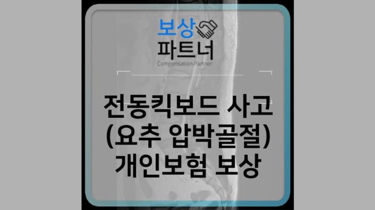 전동킥보드 단독사고로 요추압박골절, 개인보험 보상사례