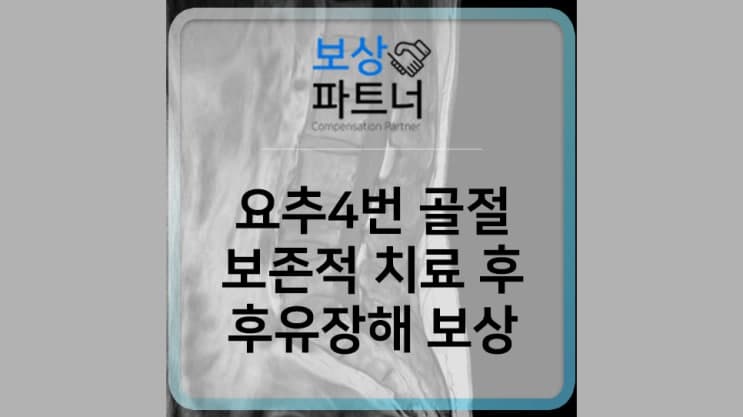 요추 4번 압박골절, 보존적 치료와 후유장해 보상 사례
