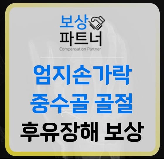 엄지손가락 중수골 및 엄지발가락 골절, 수년 전 사고도 '2,000만 원' 보상 가능